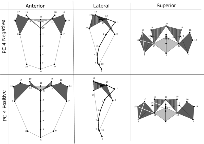 Figure 7-3 is a diagram of the right lateral