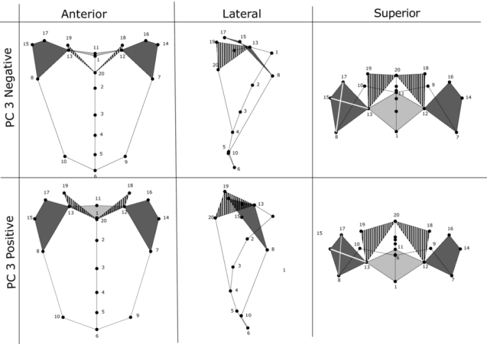 Figure 7-3 is a diagram of the right lateral