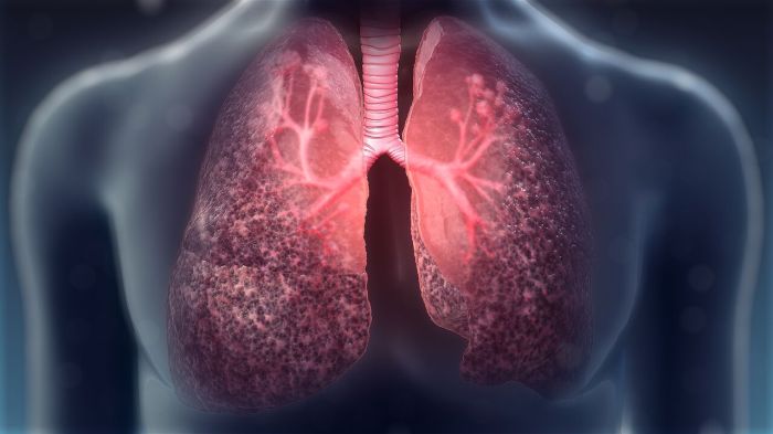 Fibrosis cystic