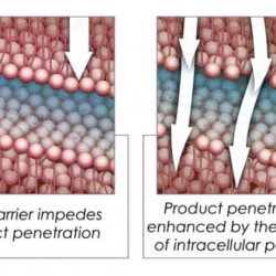 What does sonophoresis help with milady